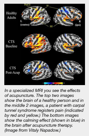 MRI