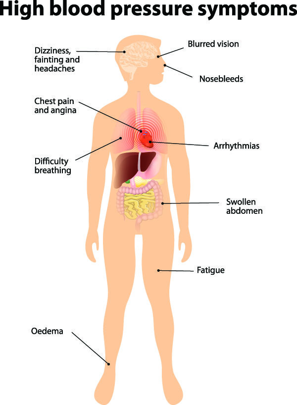 High Blood Pressure Symptons